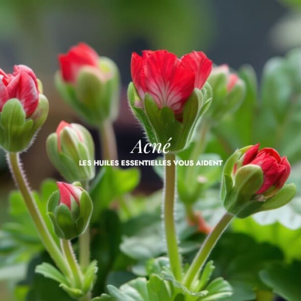 Acné : prendre soin de sa peau naturellement